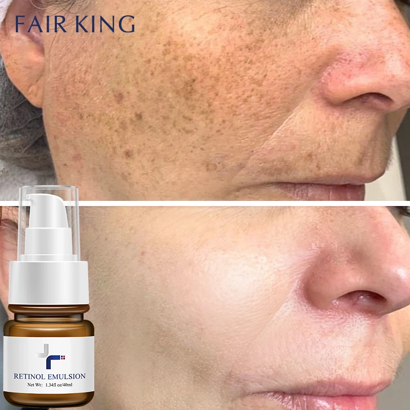 kf-S90d79e33786a4dfe98fe7a15b8acafb1R